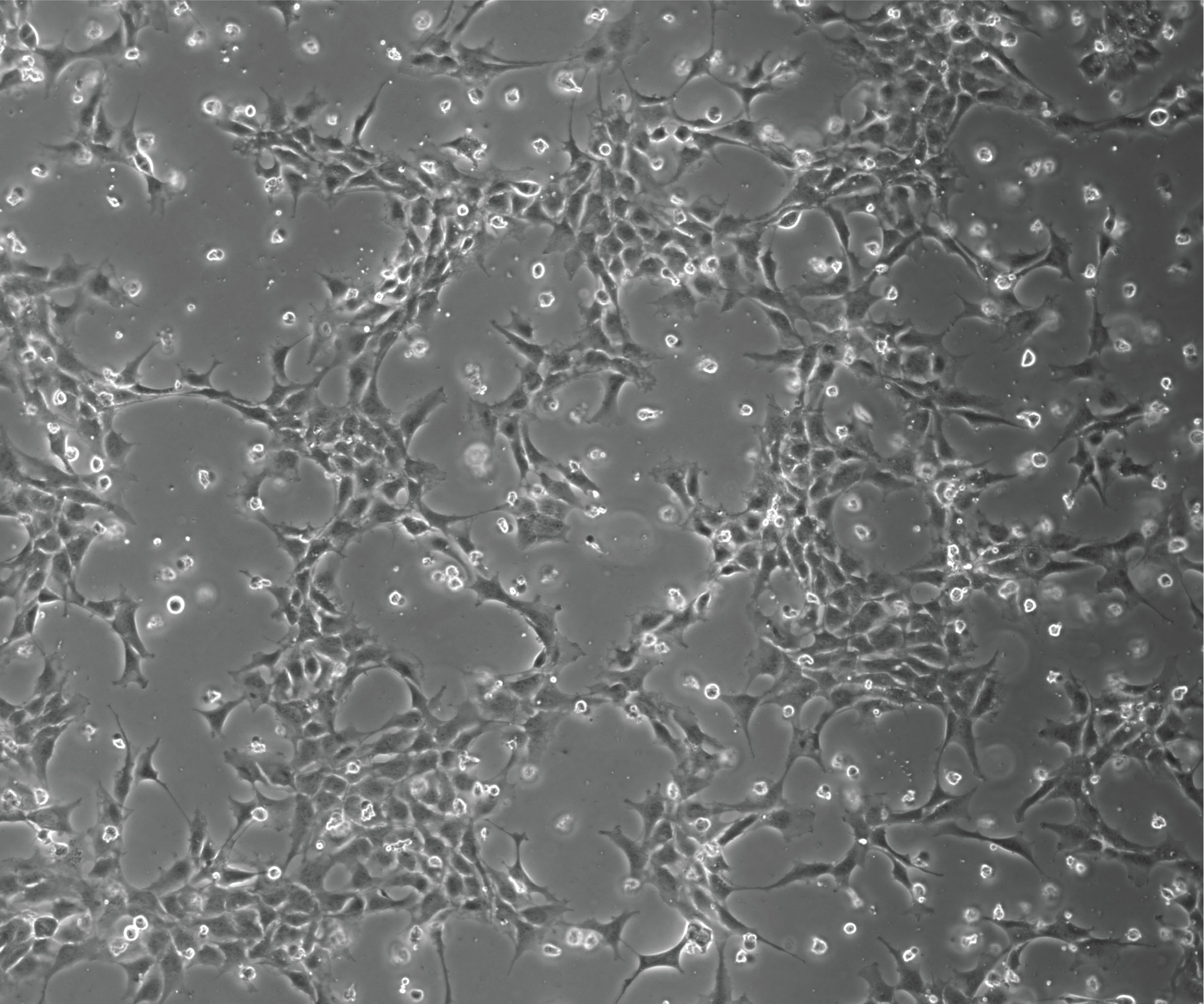 Greyscale cells seen under a microscope